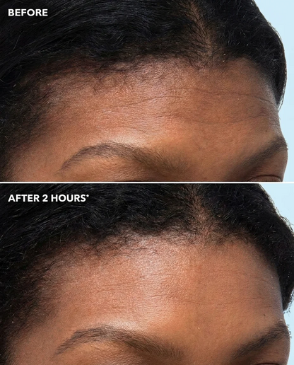 Peptide Infused Face + Eye Tape